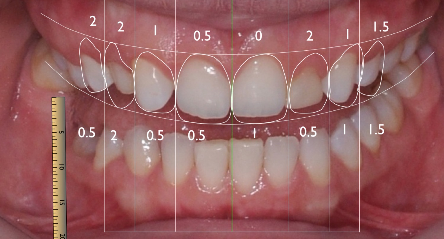 DSD smile Design